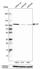 Western blot analysis in A-549 cells transfected with control siRNA, target specific siRNA probe #1 and #2, using Anti-VCP antibody. Remaining relative intensity is presented. Loading control: Anti-GAPDH.