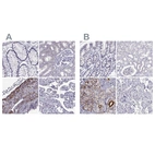 Anti-IGSF1 Antibody