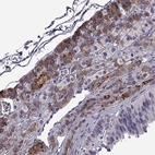 Immunohistochemical staining of human pituitary gland shows strong membranous-cytoplasmic positivity.