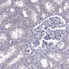 Immunohistochemical staining of human kidney shows no positivity in cells in tubules and cells in glomeruli as expected.