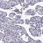 Immunohistochemical staining of human placenta shows no positivity in trophoblastic cells as expected.