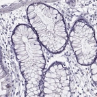 Immunohistochemical staining of human colon shows no positivity in glandular cells as expected.