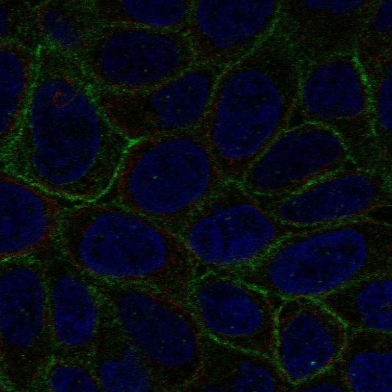 Anti-LGALS8 Antibody