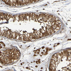 Anti-SERPINB6 Antibody
