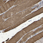 Immunohistochemical staining of human skeletal muscle shows positivity in myocytes.