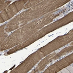 Immunohistochemical staining of human skeletal muscle shows positivity in myocytes.