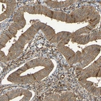 Immunohistochemical staining of human endometrium shows moderate cytoplasmic positivity in glandular cells.