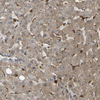 Immunohistochemical staining of human liver shows positivity in Kupffer cells.