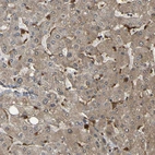 Immunohistochemical staining of human liver shows positivity in Kupffer cells.