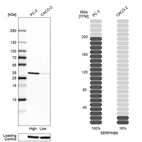Western blot analysis in human cell lines PC-3 and Caco-2 using Anti-SERPINB6 antibody. Corresponding SERPINB6 RNA-seq data are presented for the same cell lines. Loading control: Anti-HSP90B1.