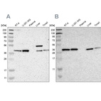 Western blot analysis using Anti-SERPINB6 antibody HPA012736 (A) shows similar pattern to independent antibody HPA009668 (B).