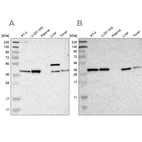 Western blot analysis using Anti-SERPINB6 antibody HPA012736 (A) shows similar pattern to independent antibody HPA009668 (B).