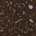 Anti-DNAJC5 Antibody