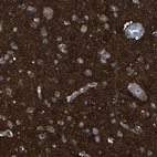 Anti-DNAJC5 Antibody