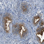 Immunohistochemical staining of human prostate shows strong membranous positivity in glandular cells.