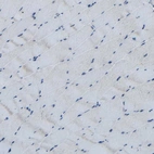 Immunohistochemical staining of human skeletal muscle shows no positivity in myocytes as expected.