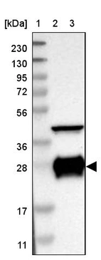 Lane 1: Marker [kDa] 230, 130, 95, 72, 56, 36, 28, 17, 11_br/_Lane 2: Human cell line RT-4_br/_Lane 3: Human cell line U-251MG sp