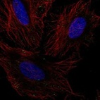 Anti-GLT8D2 Antibody