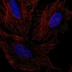 Anti-GLT8D2 Antibody