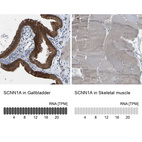 Anti-SCNN1A Antibody