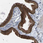 Immunohistochemical staining of human gallbladder shows high expression.
