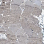 Immunohistochemical staining of human skeletal muscle shows low expression as expected.