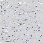 Immunohistochemical staining of human cerebral cortex shows low expression as expected.