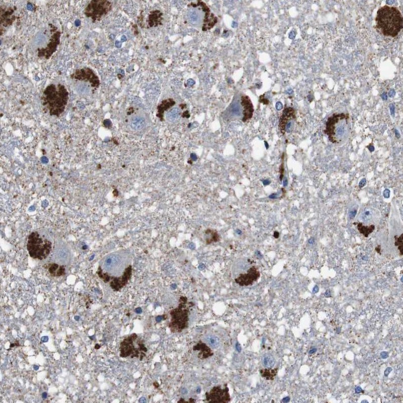 Anti-CYP2W1 Antibody