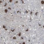 Anti-CYP2W1 Antibody