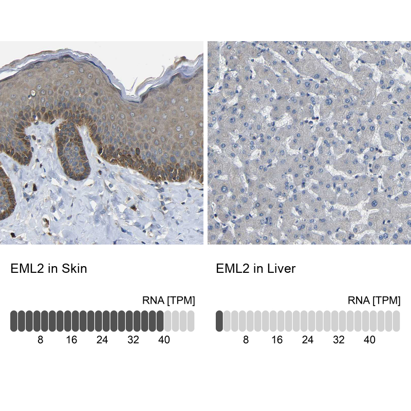 Anti-EML2 Antibody