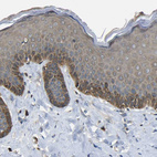 Immunohistochemical staining of human skin shows moderate cytoplasmic positivity in squamous epithelial cells.