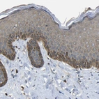 Immunohistochemical staining of human skin shows moderate cytoplasmic positivity in squamous epithelial cells.
