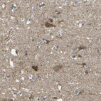 Immunohistochemical staining of human cerebral cortex shows moderate cytoplasmic positivity in neurons.