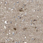 Immunohistochemical staining of human cerebral cortex shows moderate cytoplasmic positivity in neurons.