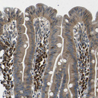 Immunohistochemical staining of human duodenum shows strong cytoplasmic positivity in lymphoid cells.