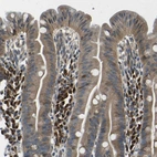 Immunohistochemical staining of human duodenum shows strong cytoplasmic positivity in lymphoid cells.