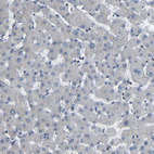 Immunohistochemical staining of human liver shows no positivity in hepatocytes as expected.