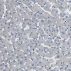 Immunohistochemical staining of human liver shows no positivity in hepatocytes as expected.
