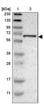 Lane 1: Marker [kDa] 230, 130, 95, 72, 56, 36, 28, 17, 11_br/_Lane 2: Human cell line RT-4