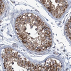 Immunohistochemical staining of human testis shows strong membranous positivity in cells in seminiferous ducts.