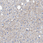 Immunohistochemical staining of human liver shows moderate membranous positivity in hepatocytes.