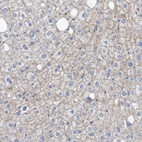Immunohistochemical staining of human liver shows moderate membranous positivity in hepatocytes.