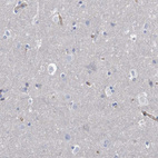 Immunohistochemical staining of human cerebral cortex shows no positivity in neurons as expected.