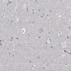 Immunohistochemical staining of human cerebral cortex shows no positivity in neurons as expected.