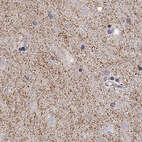 Anti-SLC6A3 Antibody