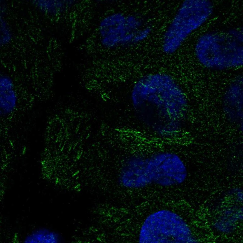 Anti-PEAK1 Antibody