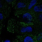 Anti-PEAK1 Antibody