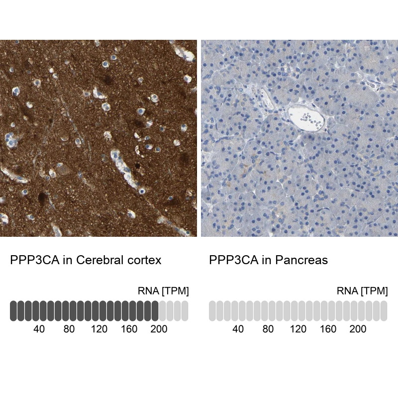 Rabbit Polyclonal Anti-PPP3CA Antibody - Buy for research - Highly ...