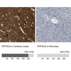 Anti-PPP3CA Antibody