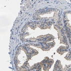 Immunohistochemical staining of human prostate shows moderate positivity in plasma membrane in glandular cells.